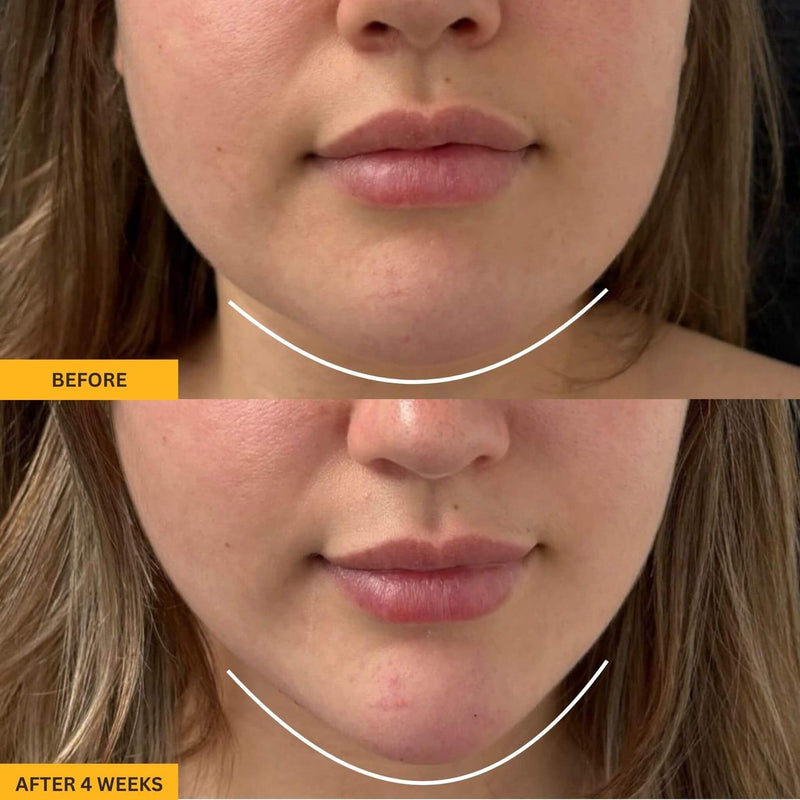 Gua Sha Brush