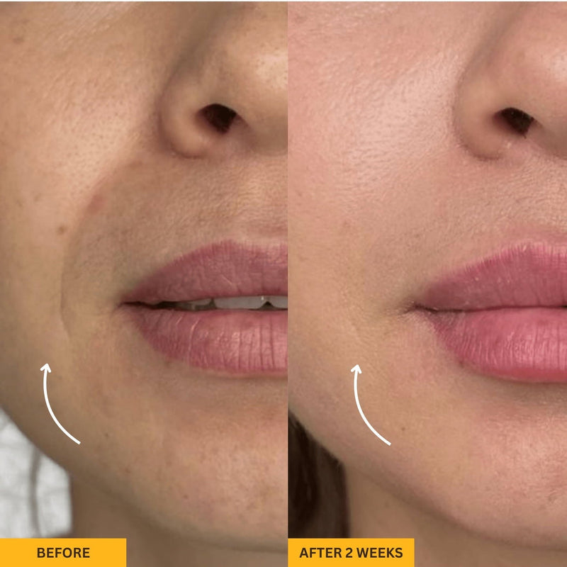 Gua Sha Brush