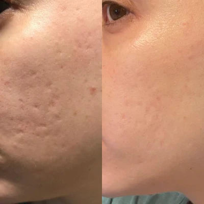 Silicone Collagen Sheets