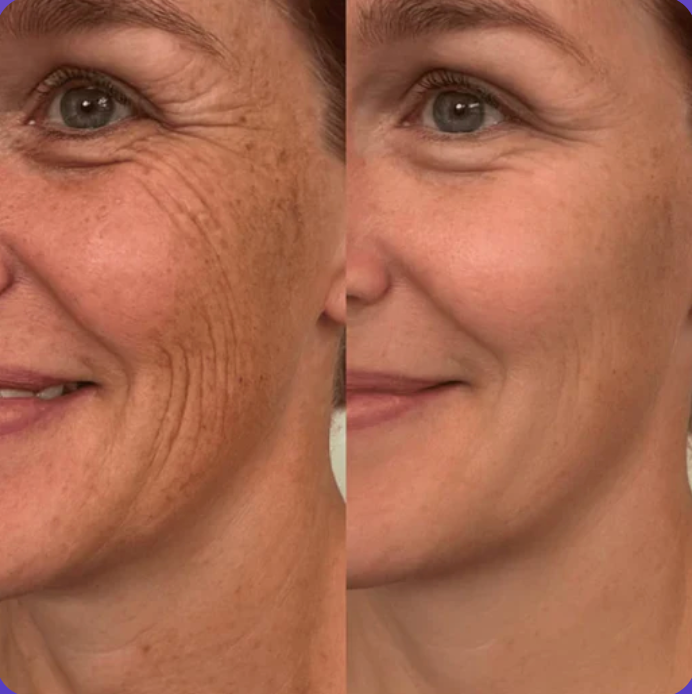 Silicone Collagen Sheets