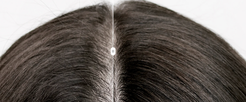 Dr.Nyra's Rosemarry Hair Growth Serum