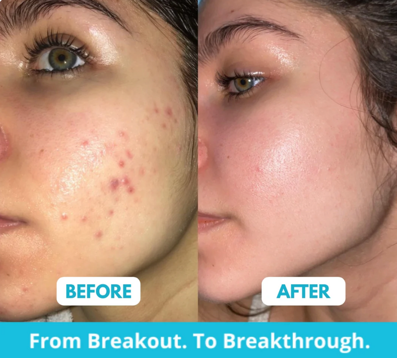 Silicone Collagen Sheets