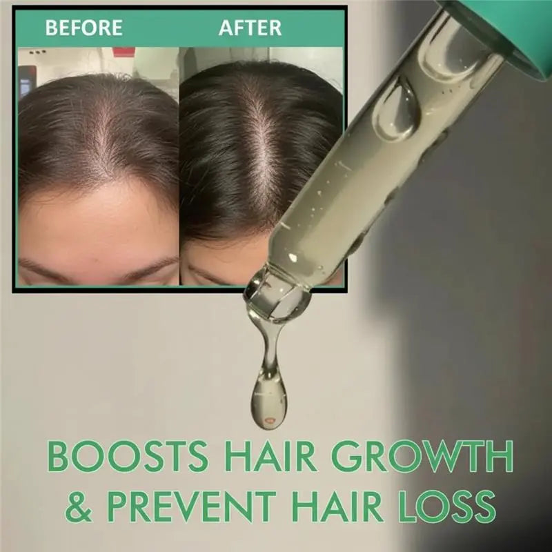 Dr.Nyra's Rosemarry Hair Growth Serum